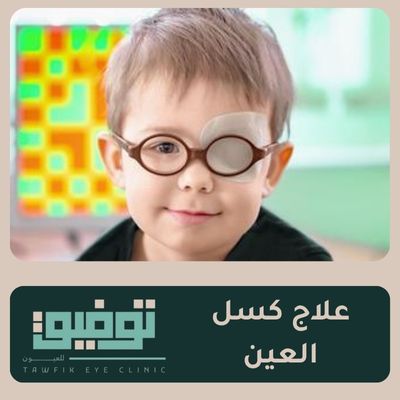 علاج كسل العين