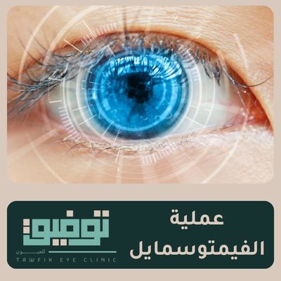 عملية الفيمتو سمايل