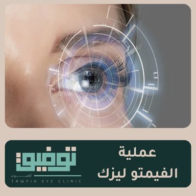 عملية الفيمتو ليزك